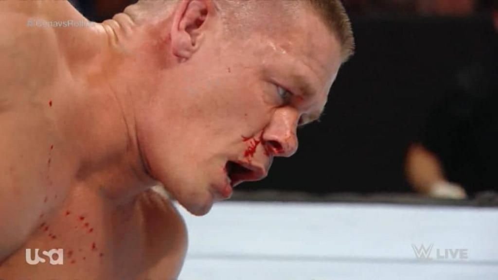 John Cena with Broken Nose