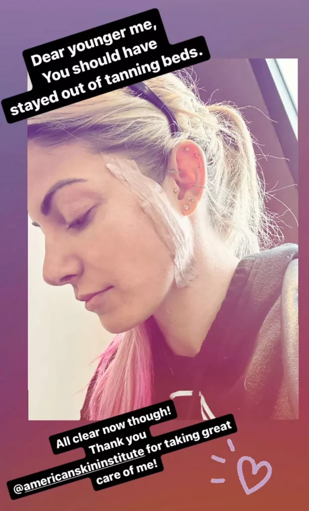 alexa bliss