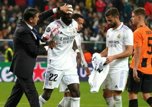 Antonio Rudiger leaves the field in agony after his head clash with Shakhtar goalkeeper